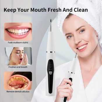 Ultrazvučni Aparat Dentalni Скалер Potrošačke Prijenosni Čistač Zuba 5-speed USB Izbjeljivanje Alat Za Uklanjanje Kamenca Za oralnu Njegu 0